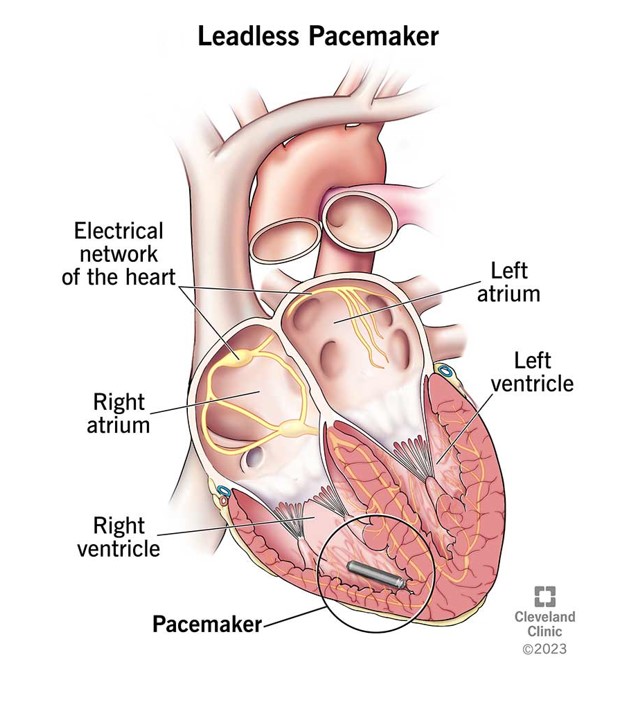 Βηματοδότες